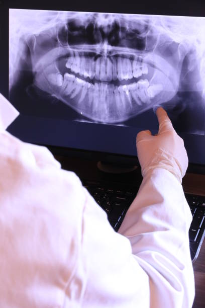 Best Emergency Root Canal Treatment in New Market, VA