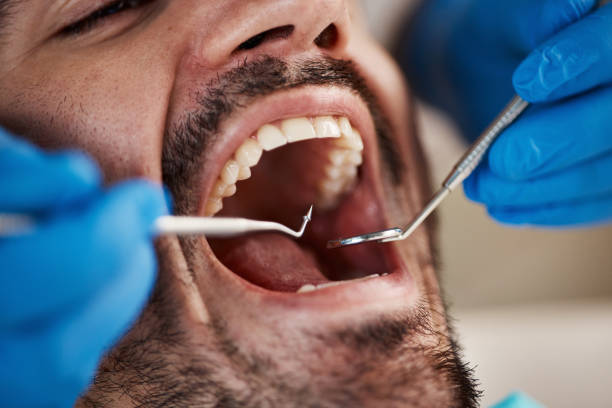 Best Emergency Treatment for Toothache in New Market, VA